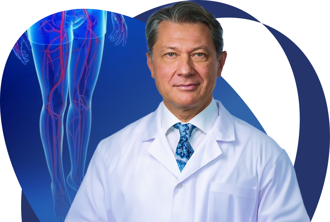 Инновационные методы лечения варикоза без операции